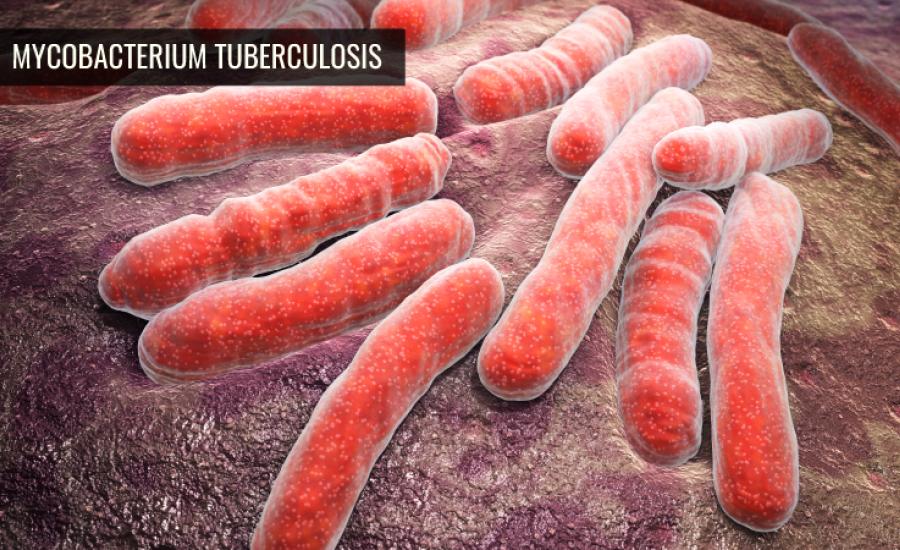 foto de la bacteria de la tuberculosis
